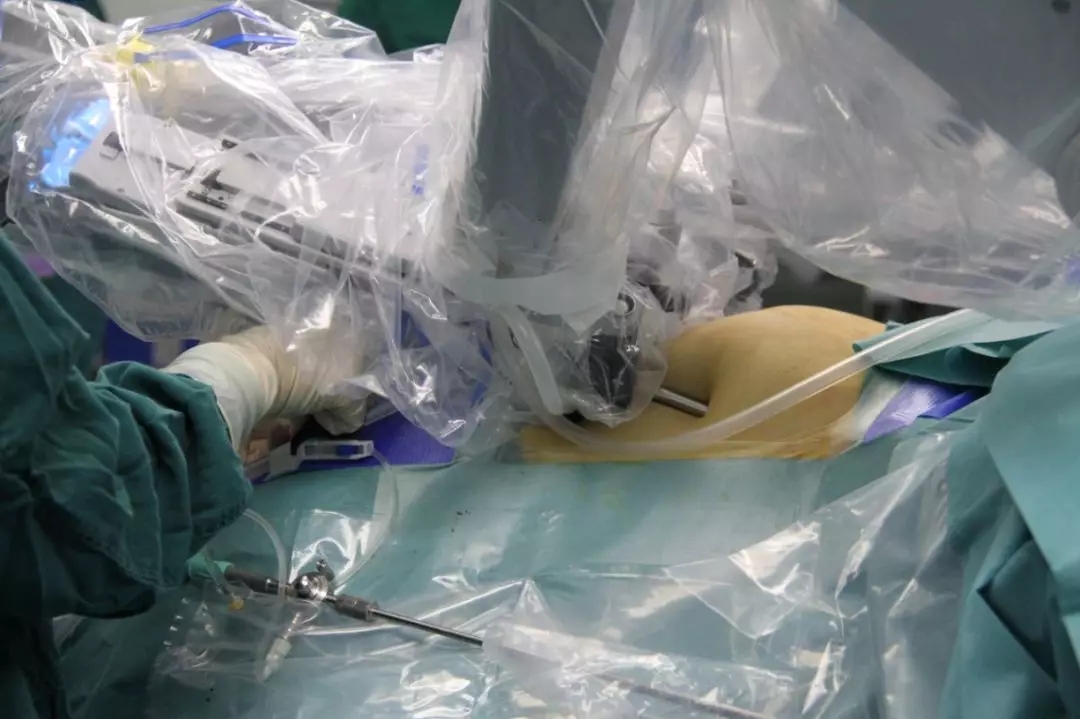 金沙洲医院成功开展首台达芬奇机器人手术，跨入“机器人时代”！